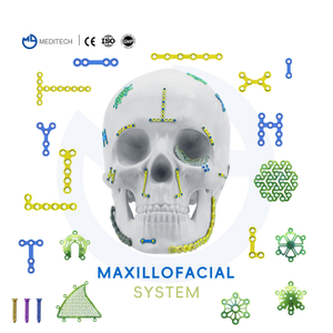 แผ่น Maxillofacial 1.5 มม.