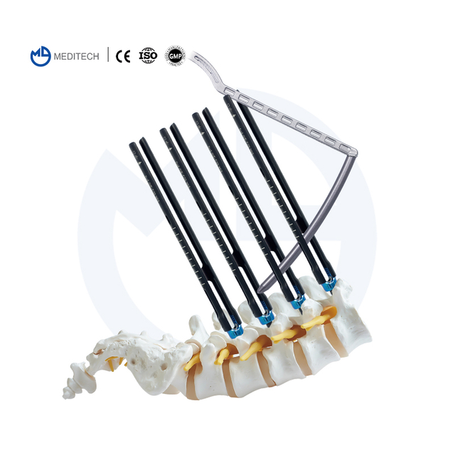 Mis Spinal Pedikel Schraube System (5.5mm System)