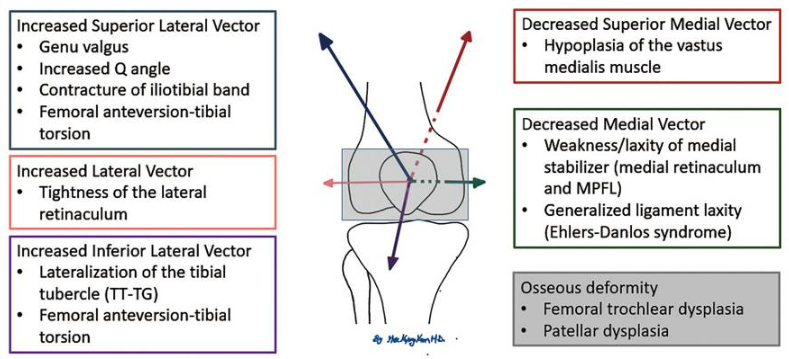 Do You Know That? Risk Factors And Treatment Of Patellofemoral Joint ...