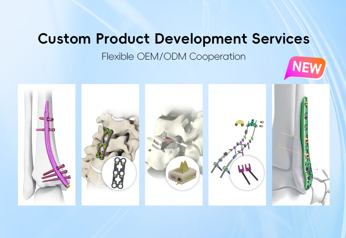 S&egrave;vis Devlopman pwodwi Custom