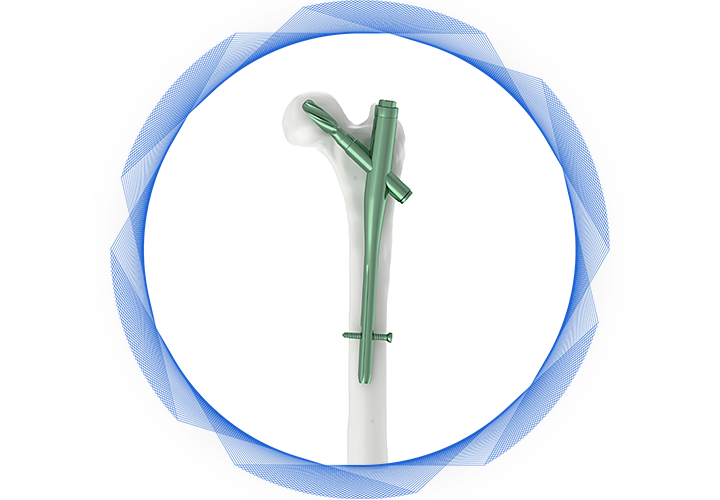 Içerki-dessurly-dyrnak
