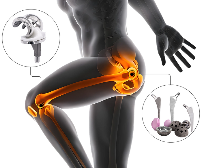 Hip&Knee